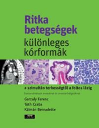 Garzuly Ferenc - Ritka betegségek, különleges kórformák a szimultán terhességtől a foltos lázig